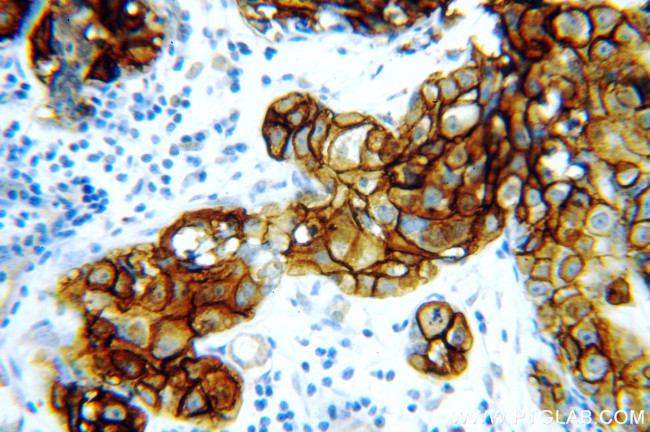 HER2/ErbB2 Antibody in Immunohistochemistry (Paraffin) (IHC (P))