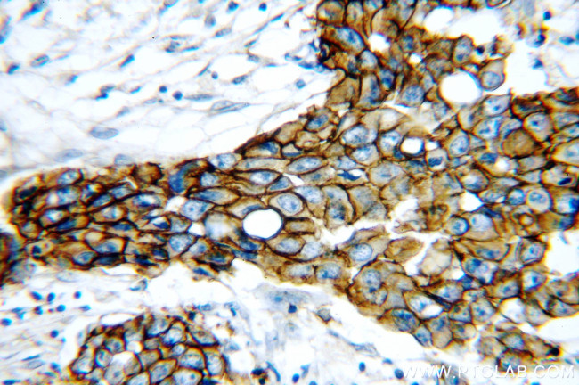 HER2/ErbB2 Antibody in Immunohistochemistry (Paraffin) (IHC (P))