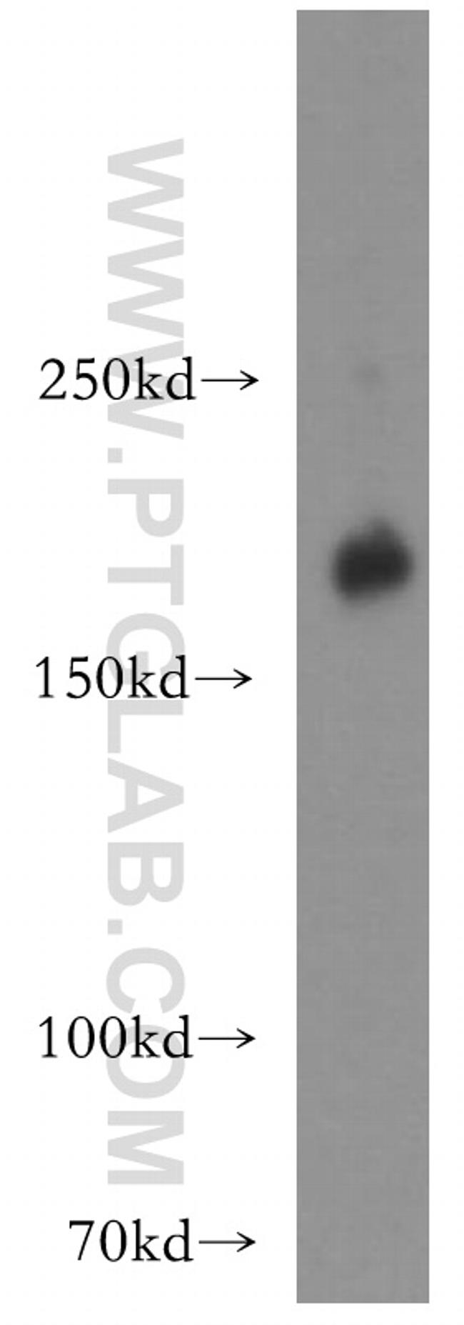 HER2/ErbB2 Antibody in Western Blot (WB)