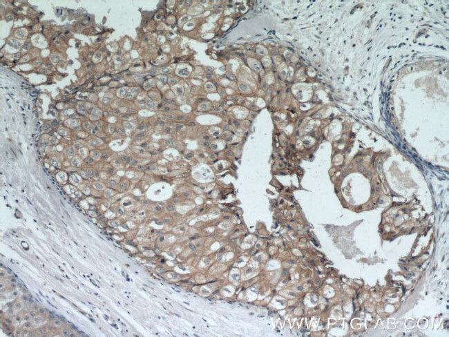 HER2/ErbB2 Antibody in Immunohistochemistry (Paraffin) (IHC (P))