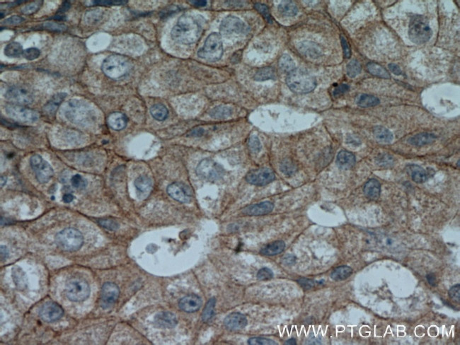 HER2/ErbB2 Antibody in Immunohistochemistry (Paraffin) (IHC (P))