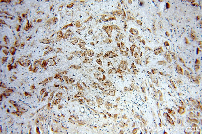 HER2/ErbB2 Antibody in Immunohistochemistry (Paraffin) (IHC (P))