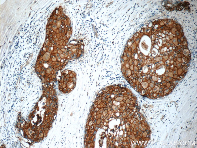 HER2/ErbB2 Antibody in Immunohistochemistry (Paraffin) (IHC (P))