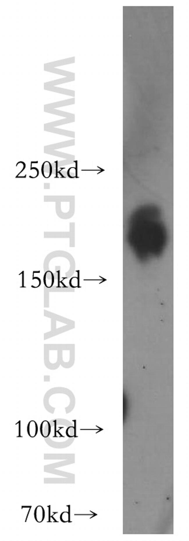 HER2/ErbB2 Antibody in Western Blot (WB)