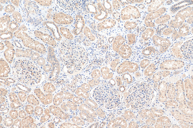 Angptl4 Antibody in Immunohistochemistry (Paraffin) (IHC (P))