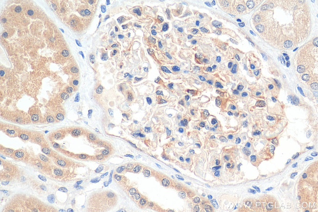 Angptl4 Antibody in Immunohistochemistry (Paraffin) (IHC (P))