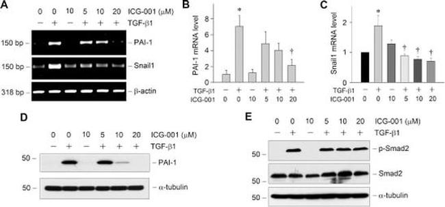 SMAD2 Antibody in Western Blot (WB)