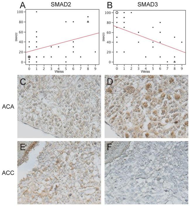 SMAD2 Antibody in Immunohistochemistry (IHC)