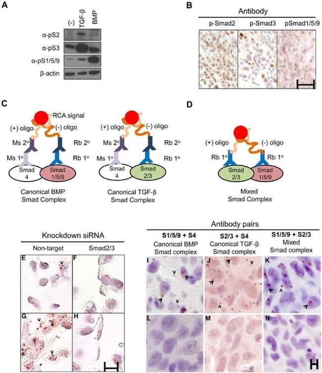 SMAD2 Antibody in Immunohistochemistry (IHC)