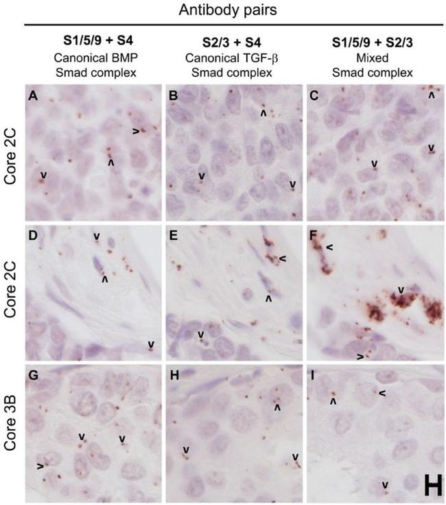 SMAD2 Antibody in Immunohistochemistry (IHC)