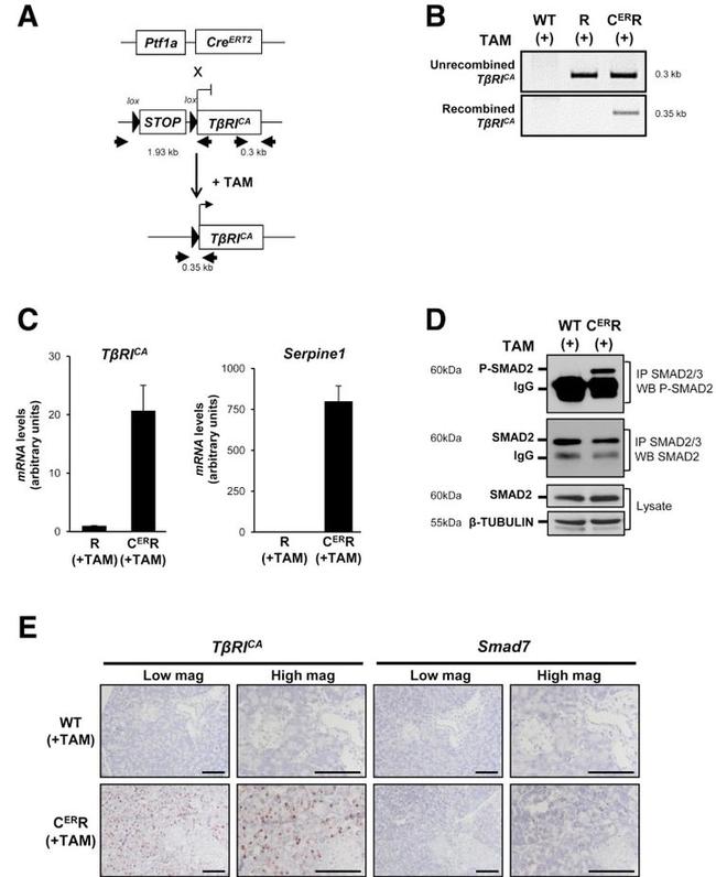 SMAD2 Antibody in Western Blot (WB)