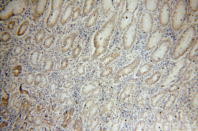 PAK1 Antibody in Immunohistochemistry (Paraffin) (IHC (P))