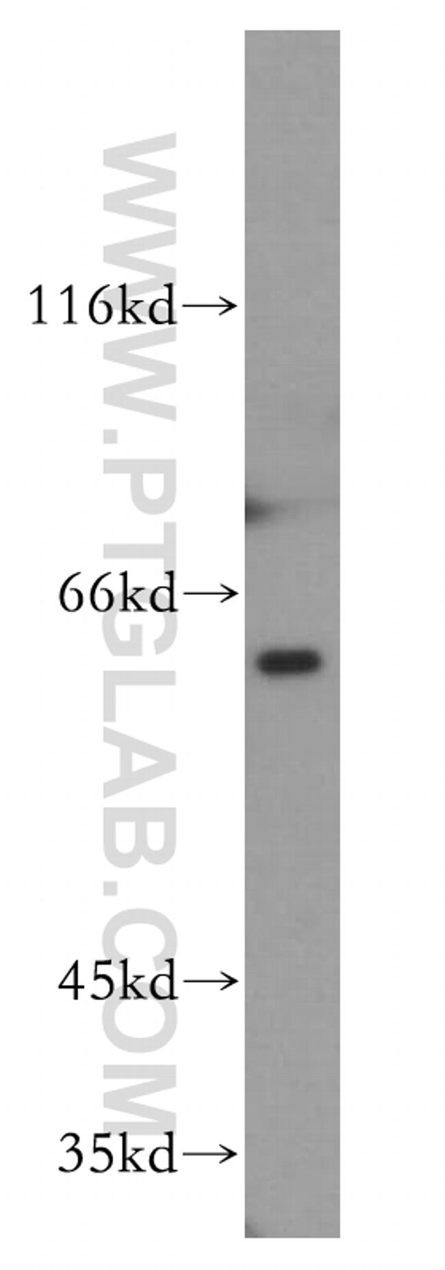 PAK1 Antibody in Western Blot (WB)