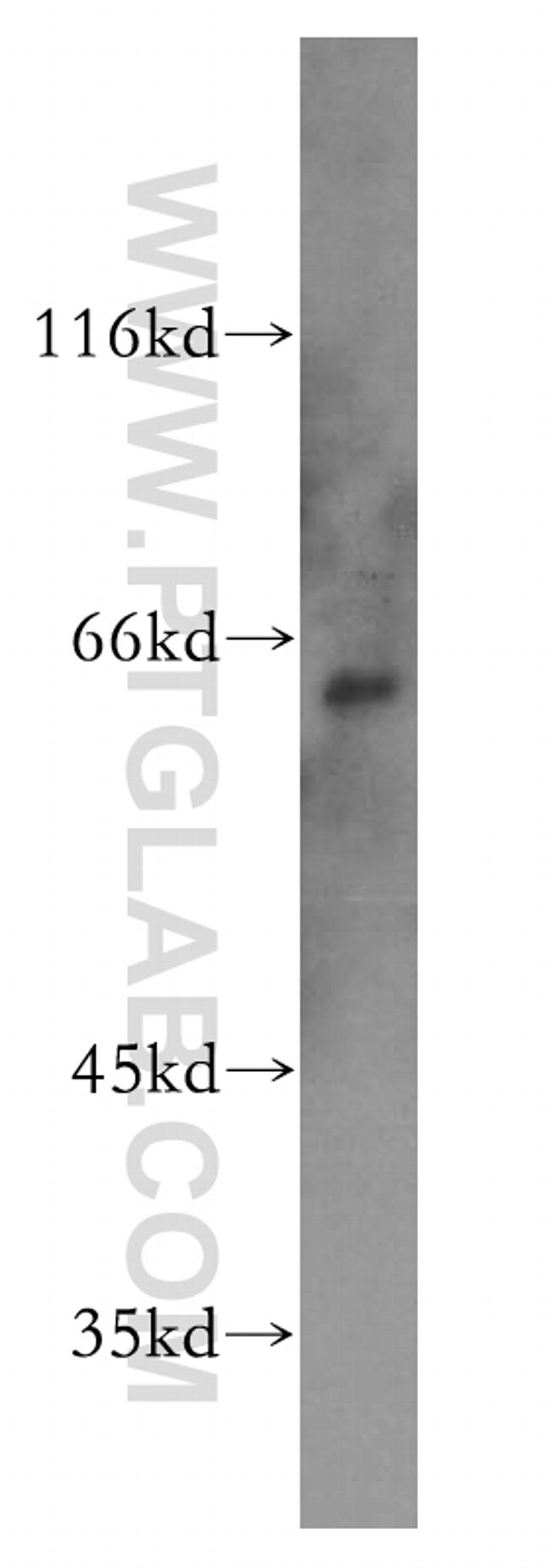 PAK1 Antibody in Western Blot (WB)