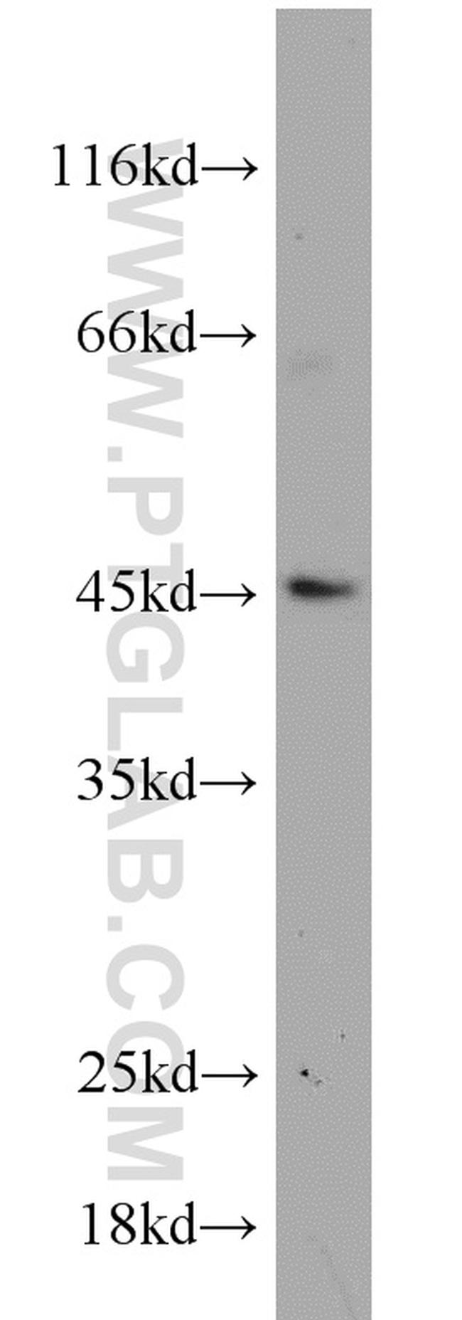 MEK4 Antibody in Western Blot (WB)