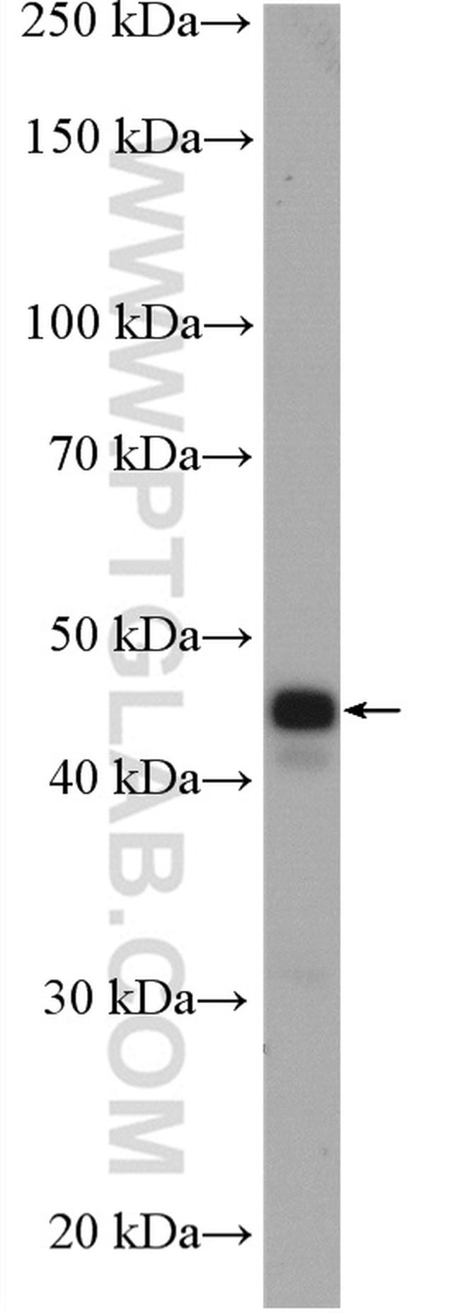 MEK4 Antibody in Western Blot (WB)