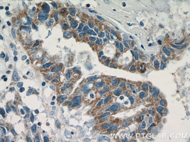 MEK4 Antibody in Immunohistochemistry (Paraffin) (IHC (P))