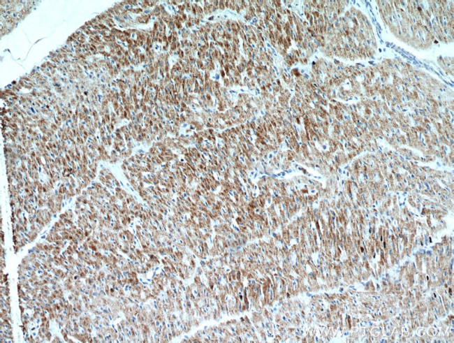 SMAD4 Antibody in Immunohistochemistry (Paraffin) (IHC (P))