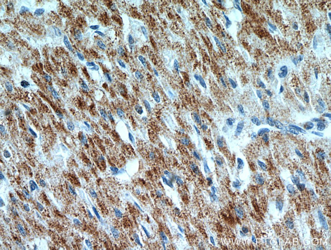 SMAD4 Antibody in Immunohistochemistry (Paraffin) (IHC (P))