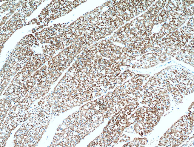 SMAD4 Antibody in Immunohistochemistry (Paraffin) (IHC (P))