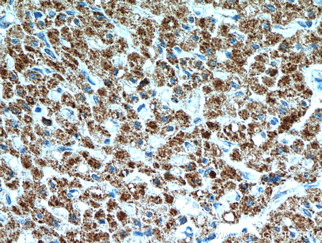 SMAD4 Antibody in Immunohistochemistry (Paraffin) (IHC (P))