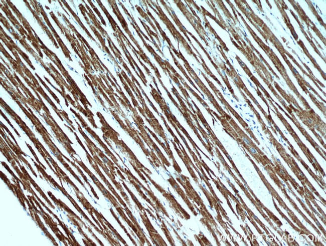 SMAD4 Antibody in Immunohistochemistry (Paraffin) (IHC (P))