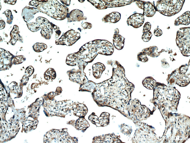 SMAD4 Antibody in Immunohistochemistry (Paraffin) (IHC (P))