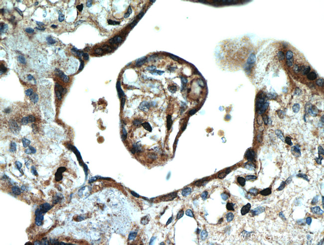 SMAD4 Antibody in Immunohistochemistry (Paraffin) (IHC (P))