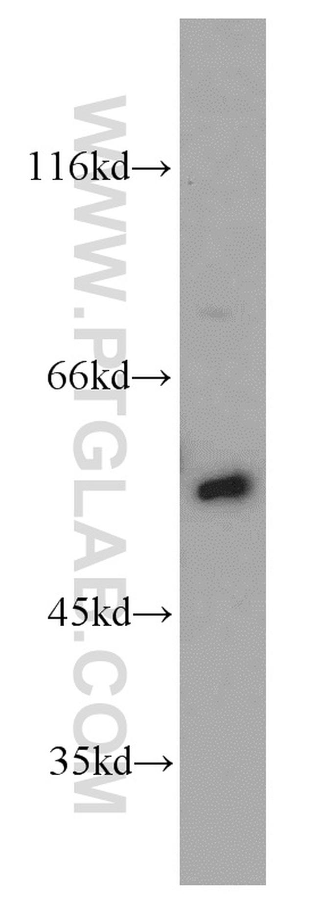 SMAD4 Antibody in Western Blot (WB)