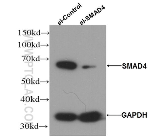 SMAD4 Antibody in Western Blot (WB)