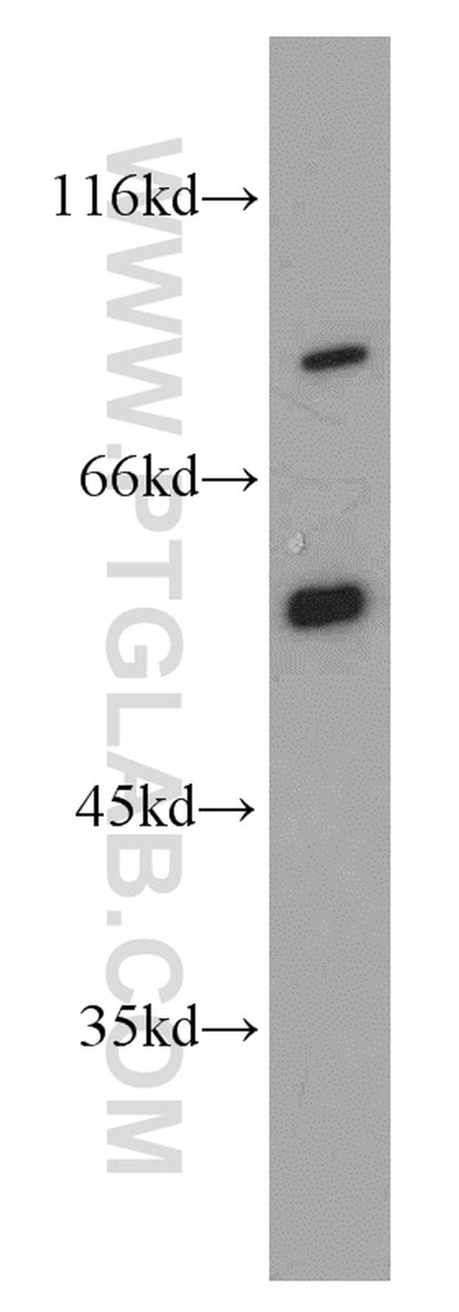 SMAD4 Antibody in Western Blot (WB)