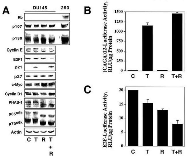 SMAD3 Antibody in Western Blot (WB)