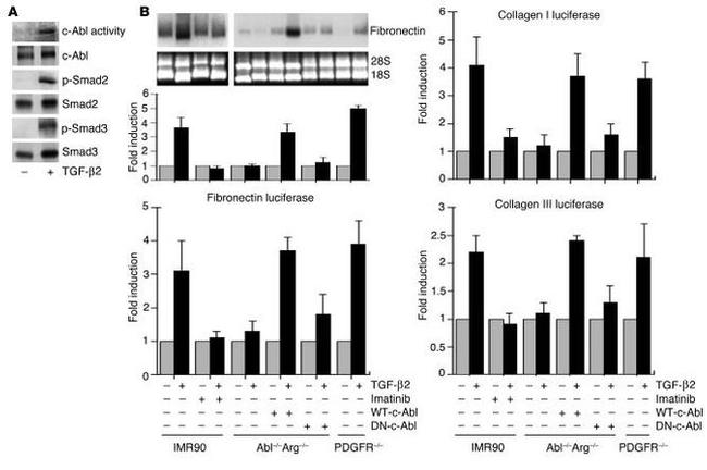 SMAD3 Antibody in Western Blot (WB)