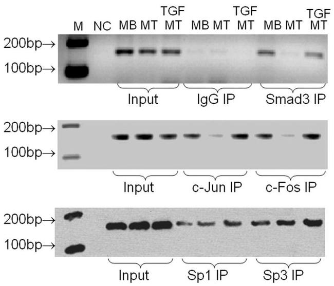 SMAD3 Antibody in ChIP Assay (ChIP)