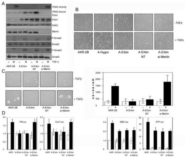 SMAD3 Antibody in Western Blot (WB)