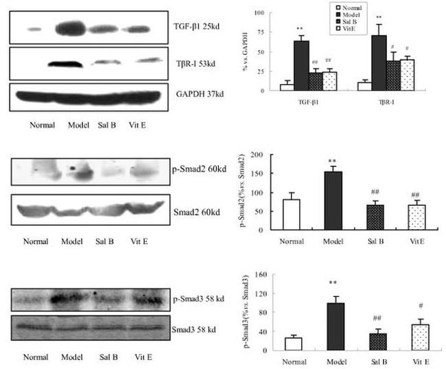 SMAD3 Antibody in Western Blot (WB)