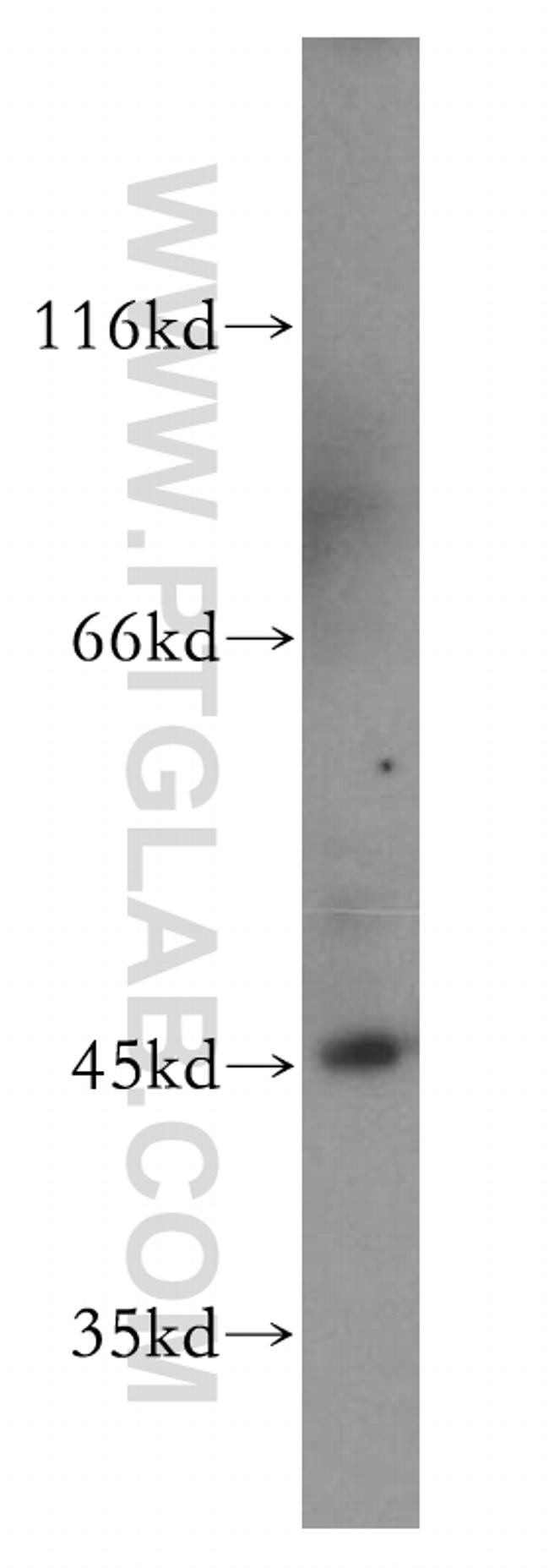 JNK Antibody in Western Blot (WB)