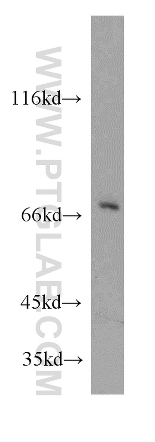 ATP6V1A Antibody in Western Blot (WB)