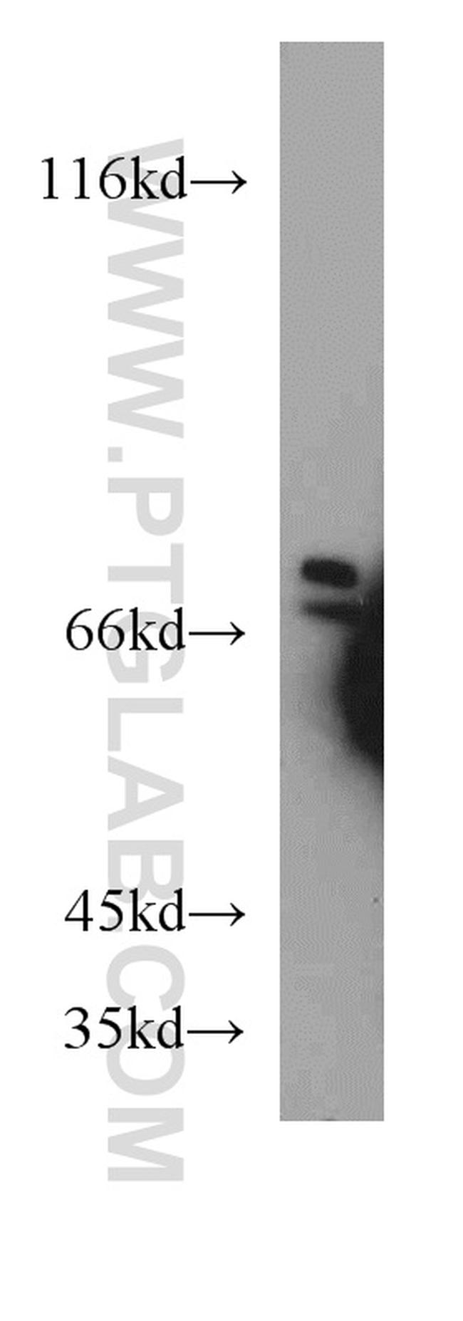 ATP6V1A Antibody in Western Blot (WB)