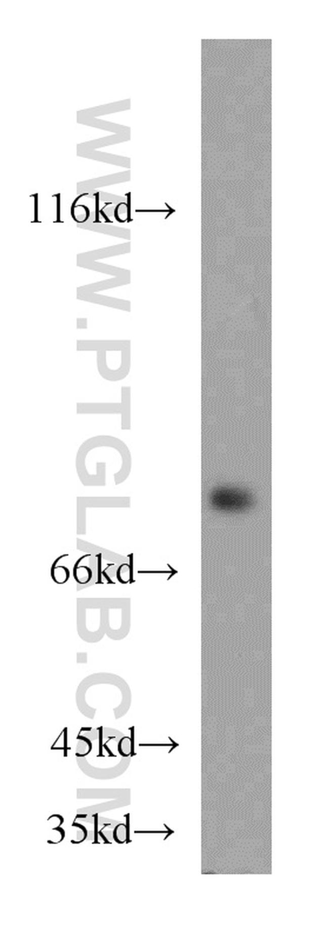 ATP6V1A Antibody in Western Blot (WB)