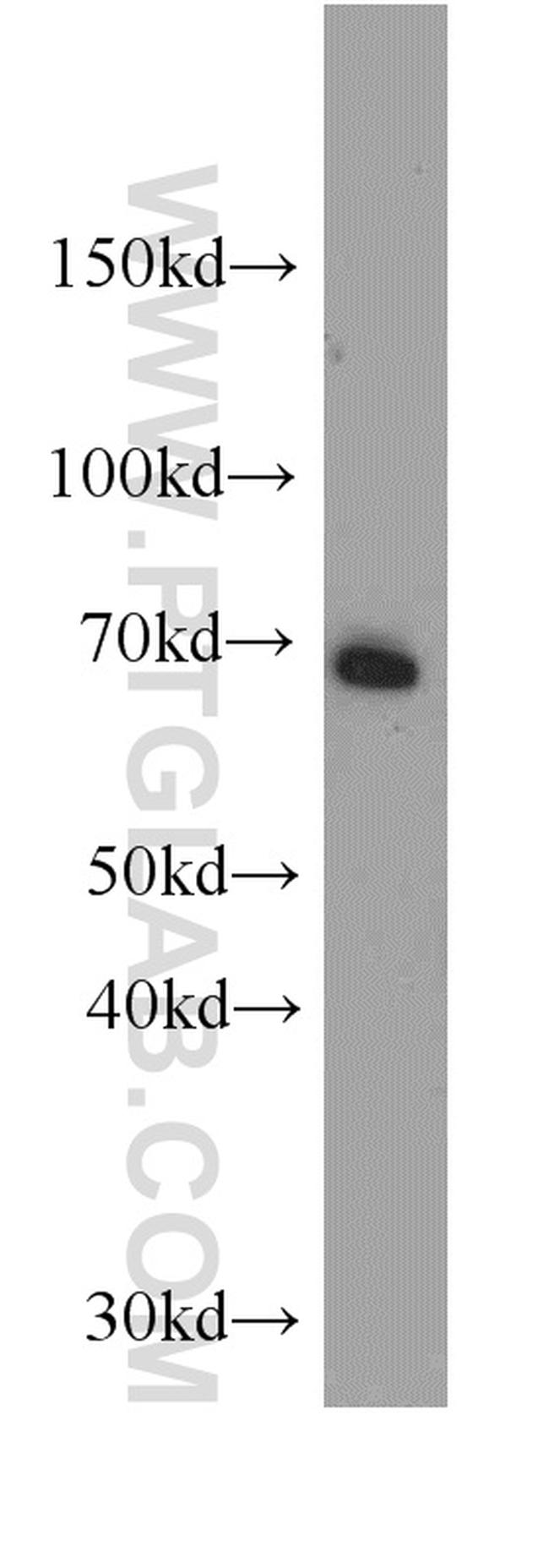 ATP6V1A Antibody in Western Blot (WB)