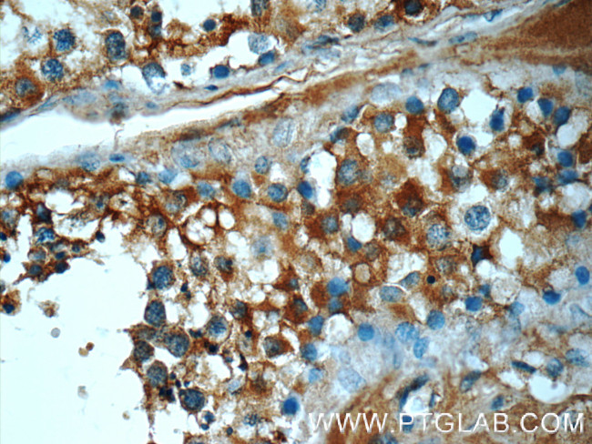 ATP6V1A Antibody in Immunohistochemistry (Paraffin) (IHC (P))