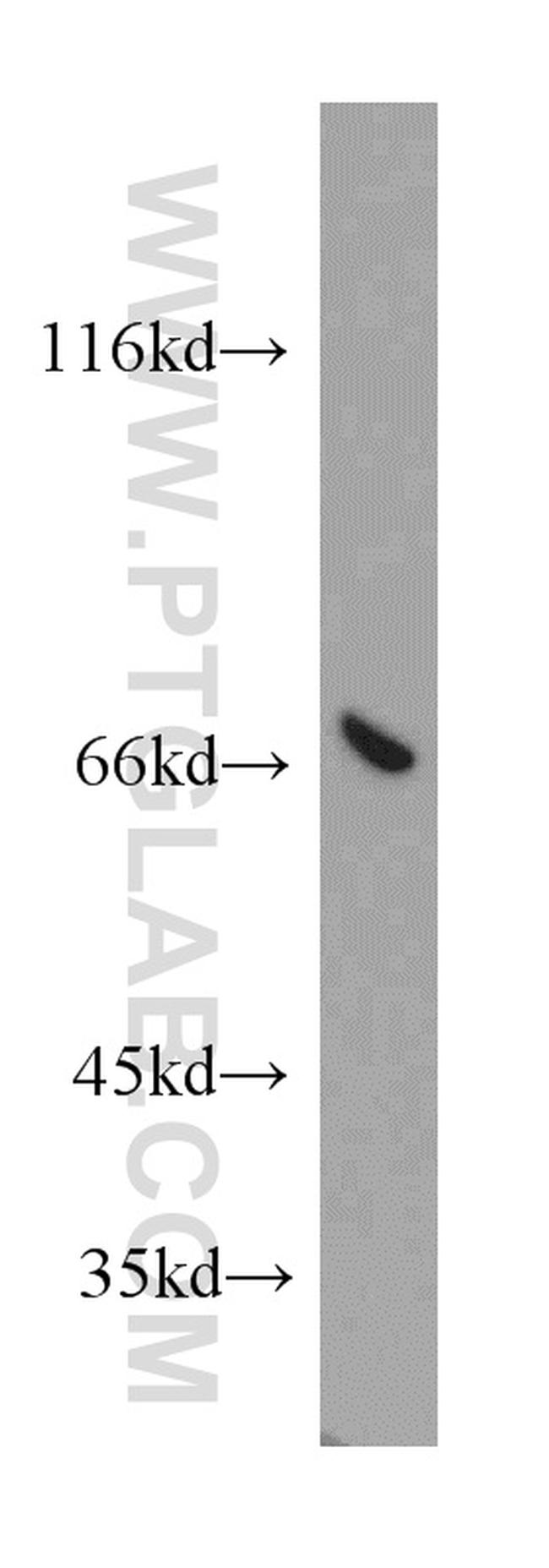 ATP6V1A Antibody in Western Blot (WB)