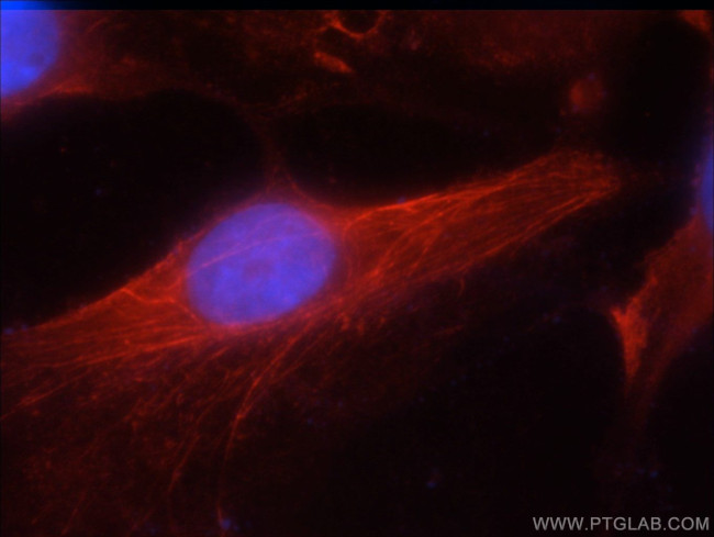 JNK2 Antibody in Immunocytochemistry (ICC/IF)