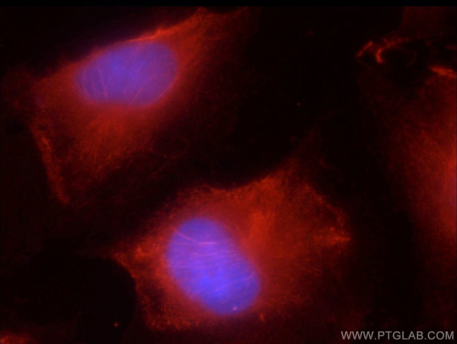 JNK2 Antibody in Immunocytochemistry (ICC/IF)