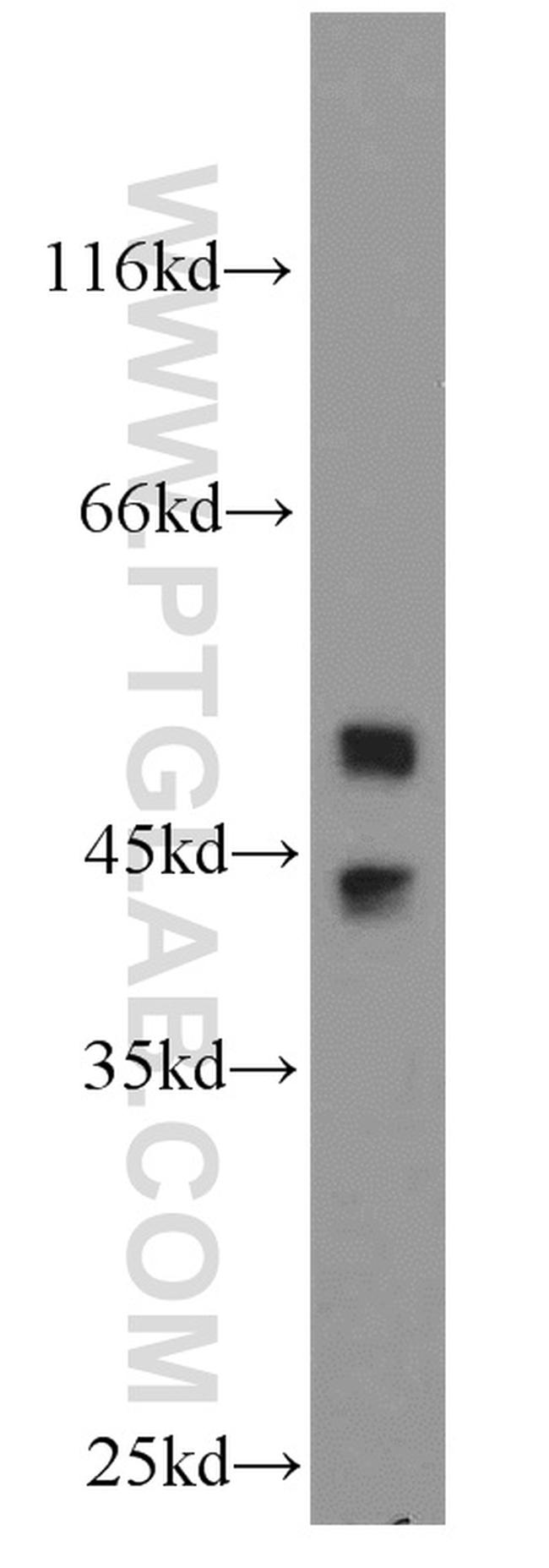 JNK2 Antibody in Western Blot (WB)