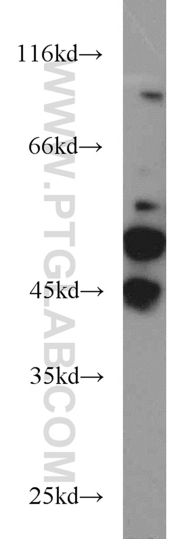 JNK2 Antibody in Western Blot (WB)