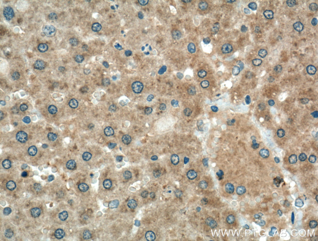 Cyp4a12a Antibody in Immunohistochemistry (Paraffin) (IHC (P))