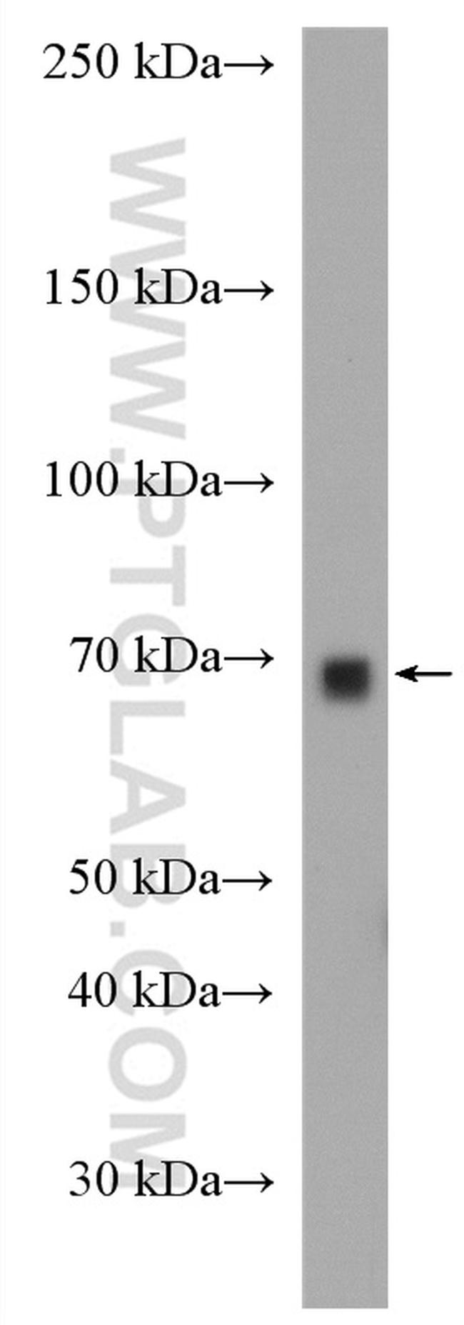 Cyp4a12a Antibody in Western Blot (WB)