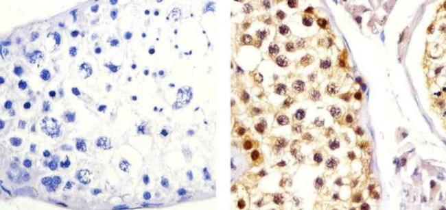 Cullin 2 Antibody in Immunohistochemistry (Paraffin) (IHC (P))